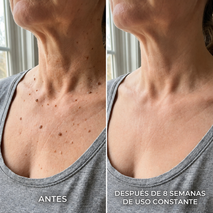 Crema queratolítica avanzada para piel áspera y elevada